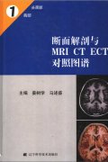 MRI CT ECTͼ-ͷ....pdf