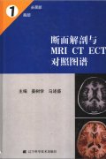 MRI CT ECTͼ-ͷ....pdf