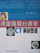 ­Ǹ߷ֱCTͼף񳣣.pdf